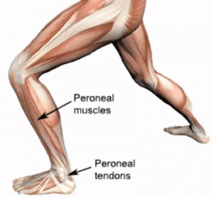The Peroneals – Peroneus Longus Pain Running