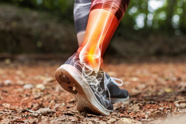 Commonly missed signs of injury - how can physiotherapy help?